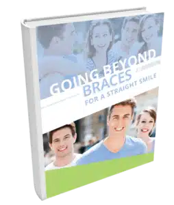 going beyond braces ebook web