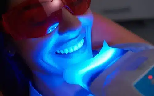 teeth whitening dentist