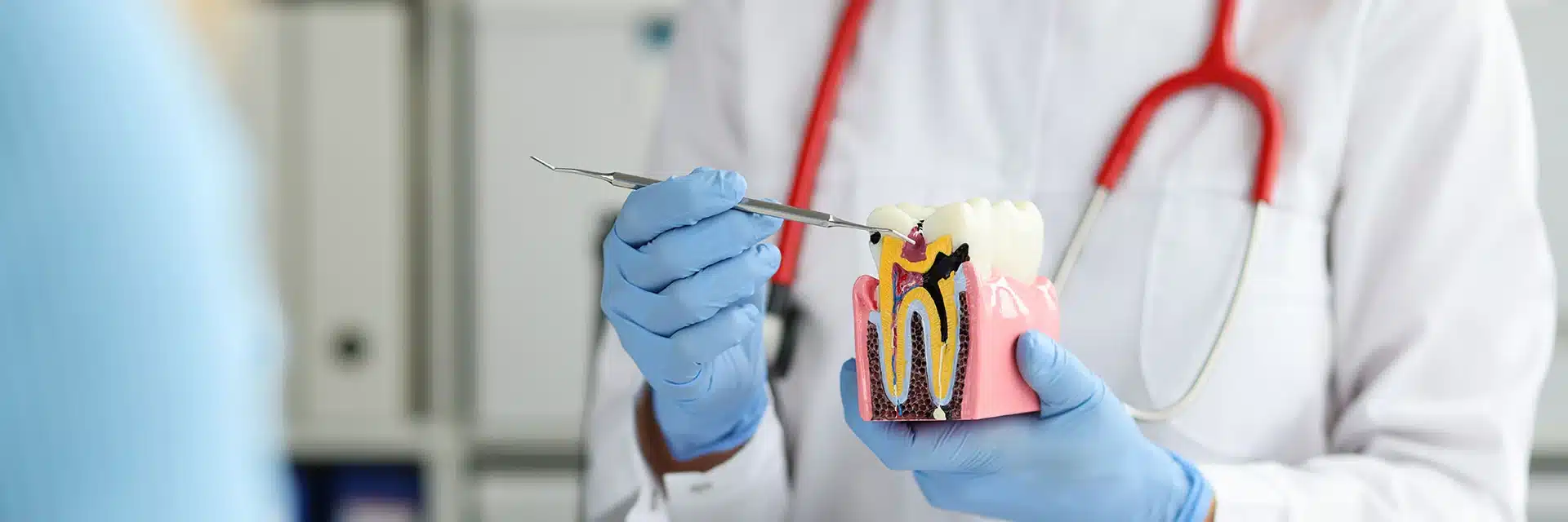 Understanding the Root Canal Procedure